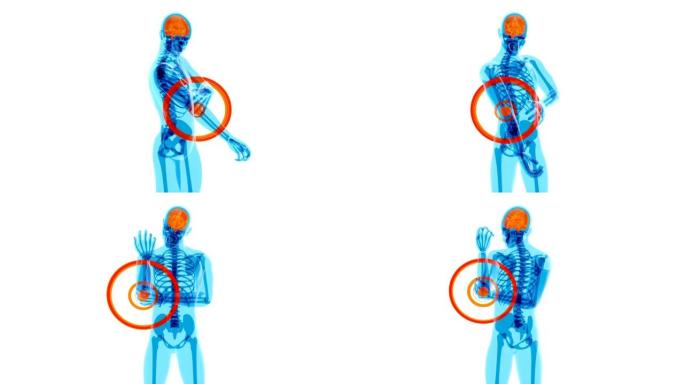肘部疼痛的4k解剖学概念