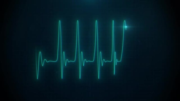 医疗脉搏心跳心电图真实在监视器上