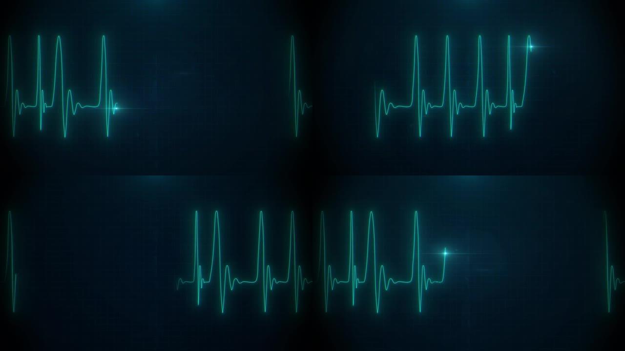 医疗脉搏心跳心电图真实在监视器上