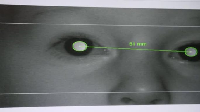 眼科诊所眼科设备屏幕瞳距视野的测量。视力问题