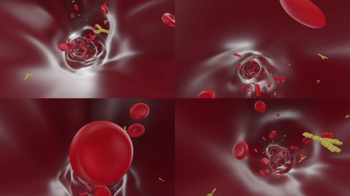 血管: 具有抗体的红细胞