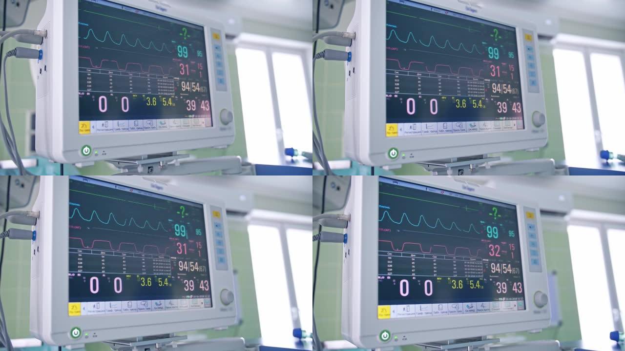 手术室的手术麻醉机显示生命和脉搏指标