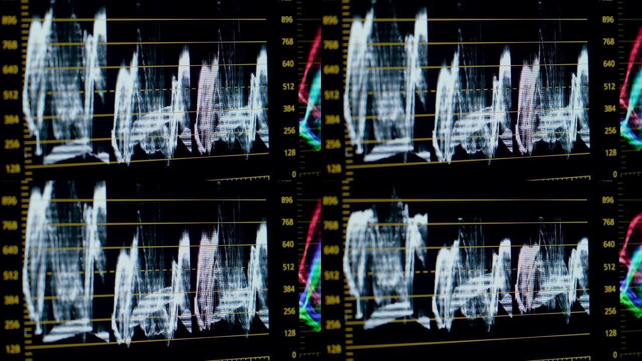 色彩校正后期制作视频或照片进行中特写。一种用于视频处理、色彩校正的程序。颜色曲线，宏