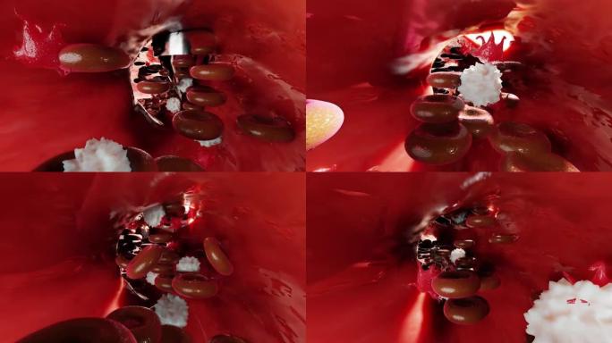 止血。血管中的红细胞和血小板。伤口愈合过程的基本步骤。动画。3d渲染