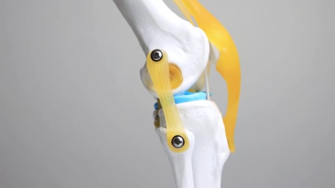 白色背景上的屈曲伸展膝关节布局。膝关节软骨疾病、关节病的概念。膝盖治疗，医疗保健
