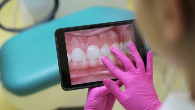 牙医诊所的健康牙齿患者龋齿预防