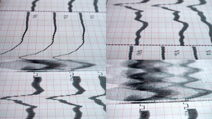波信号科学科技