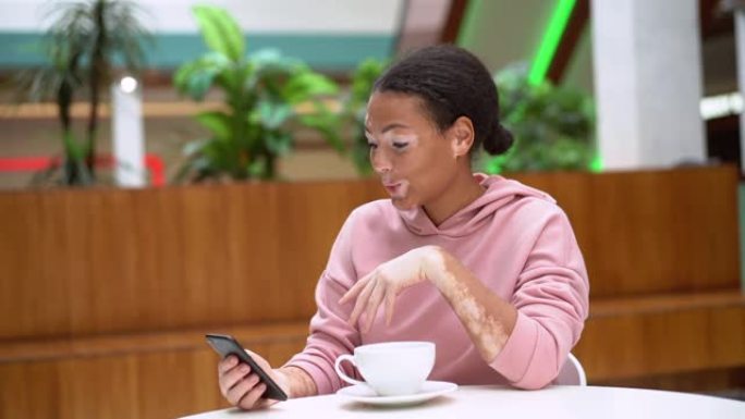 患有白癜风色素沉着皮肤问题的黑人非洲裔美国妇女室内穿着粉色连帽衫在智能手机上通过视频聊天