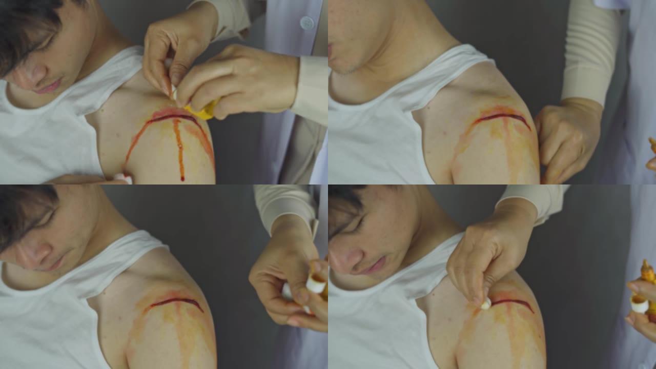 医生用棉球和敷料清洁肩部伤口，伤口护理过程