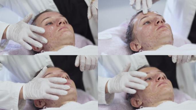 美容诊所接受补水手术的女性客户特写，在油性痤疮皮肤上涂抹补水霜