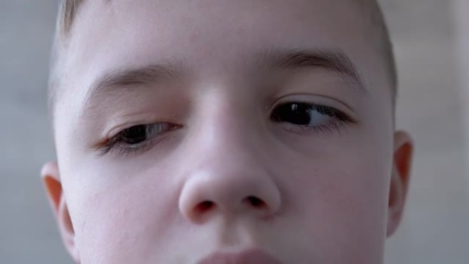 双眼睑下垂的男孩少年，长睫毛，旋转眼睛。上睑下垂。4K