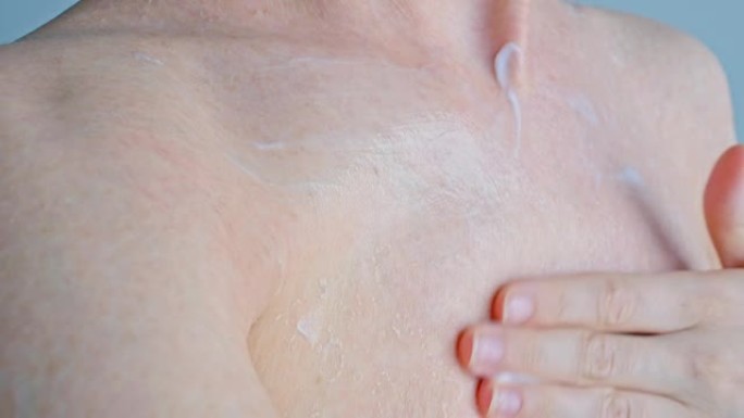 一名妇女在裸露的身体上涂抹白色保湿霜，皮肤会破裂并起泡。皮肤问题。身体护理。特写