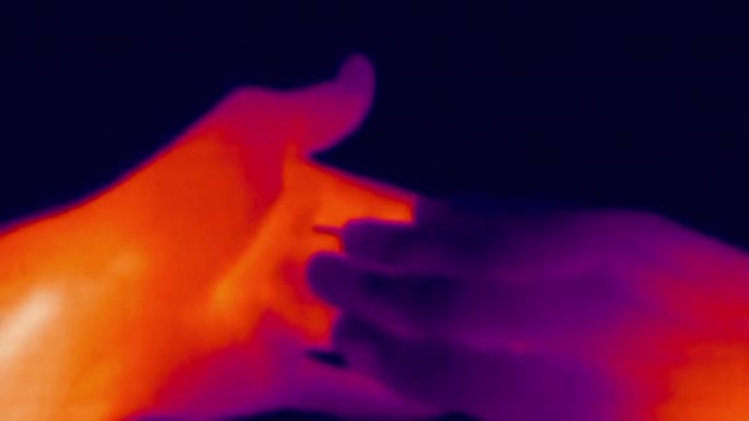 冻伤手的热成像图。红外、热成像、夜视成像