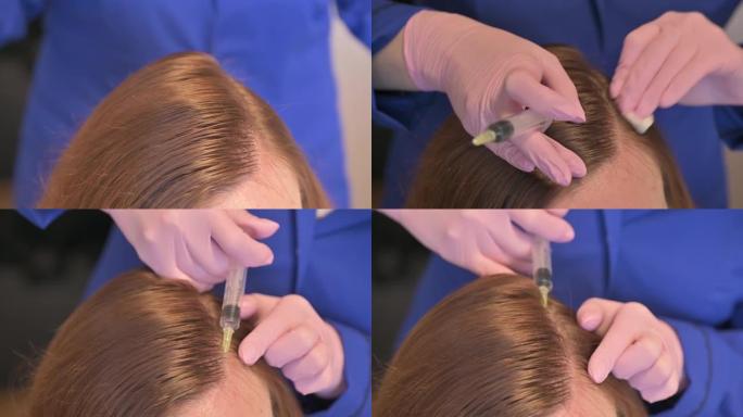 美容师在女性的头皮中注射维生素和矿物质，以防止或减缓脱发