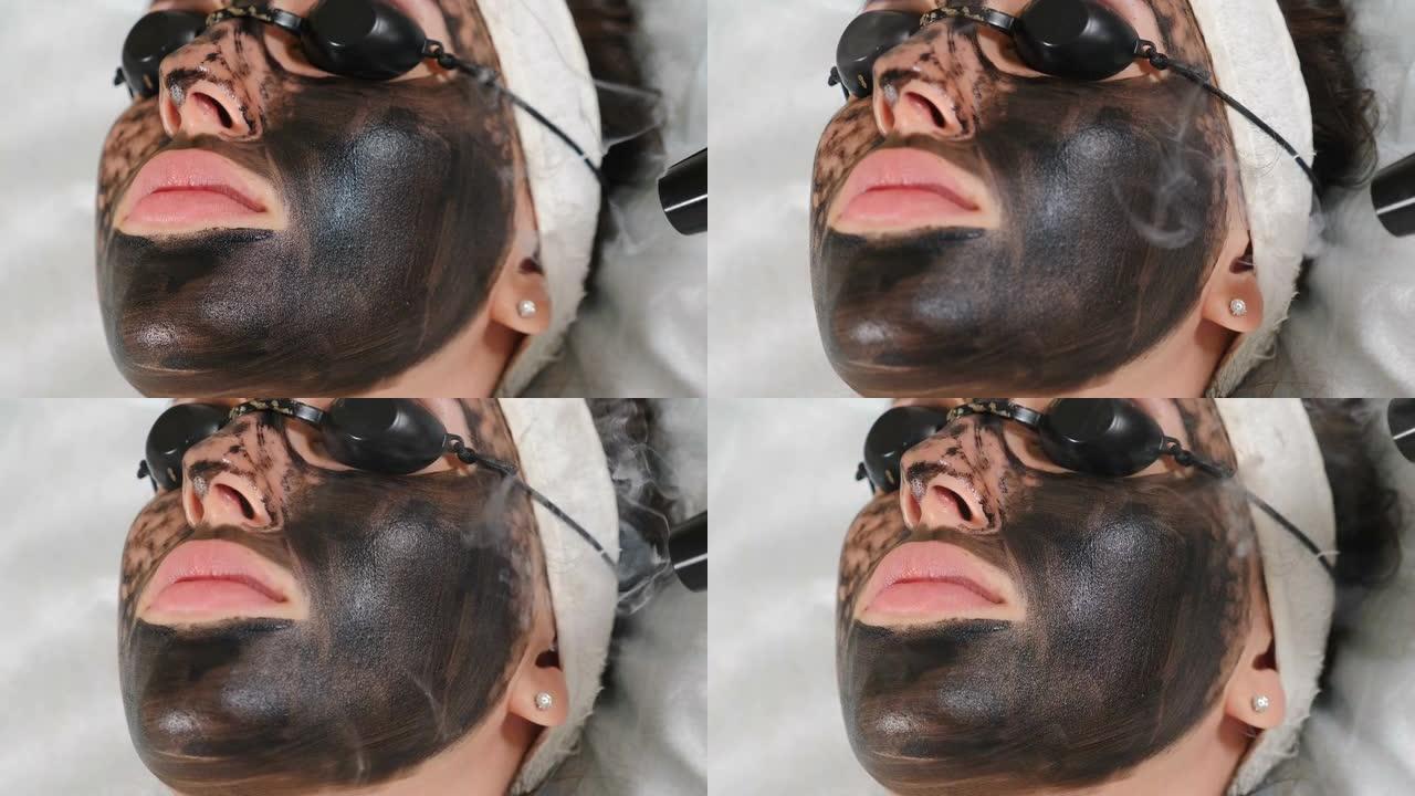 美容师制作碳疗法面部脱皮程序。激光脉冲清洁面部皮肤。硬件美容。光热解、温热皮肤、激光脱皮过程。面部皮