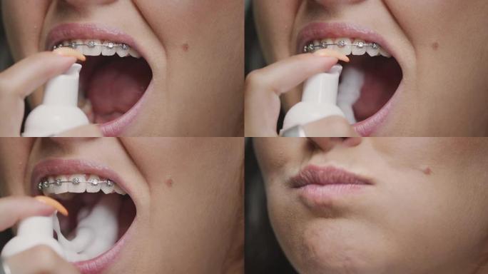 牙齿和牙套清洁。通过清洁泡沫牙膏刷牙的女性特写。牙齿卫生