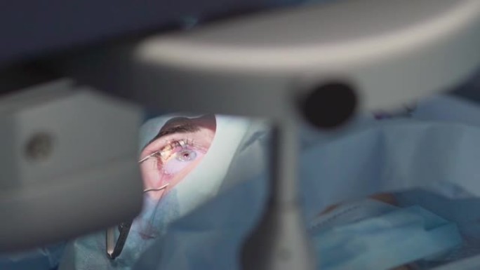 激光视力矫正。移除眼部手术用眼垫片。激光视力矫正。眼科手术期间手术室的患者