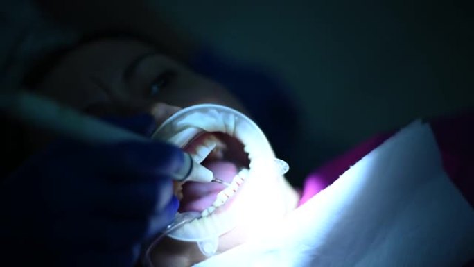 牙医用超声波对病人进行口腔卫生。