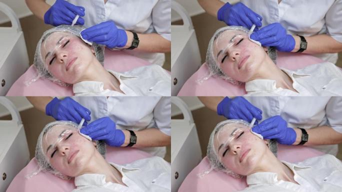 美容师在女性客户的面部和口腔区域进行注射。皮肤生物活化法、营养和保湿疗法。皮肤科诊所的美女
