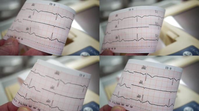 心电记录仪检查