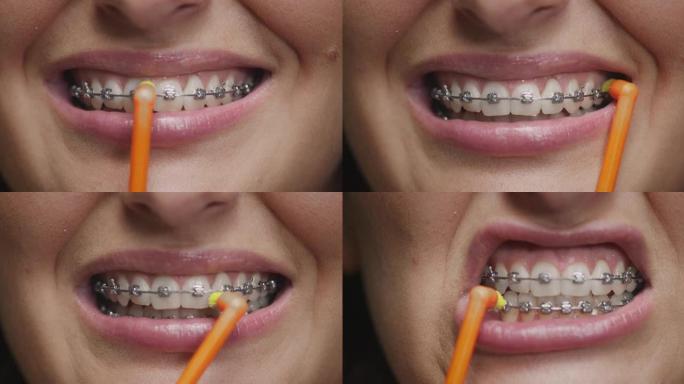 刷牙。用牙刷清洁搪瓷的特写女人。牙齿卫生，牙科，正畸护理