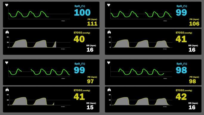 监测二氧化碳描记术和血氧描记术-氧描记术