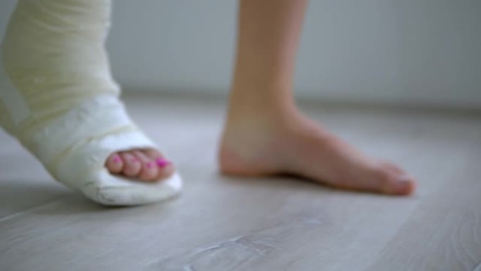 女人的断脚在石膏石膏中试图走路的特写镜头，腿部受伤后在家中康复的概念