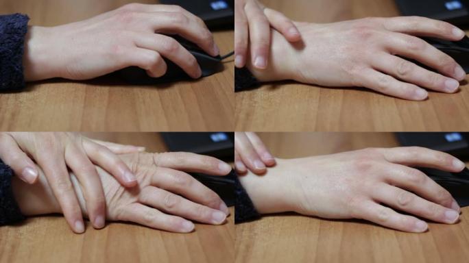 大量使用计算机鼠标引起的成年女性手腕肌腱炎。