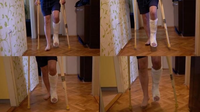 断腿的成熟男人在家里用拐杖走路