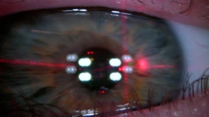 在眼科激光视力矫正操作期间，准分子激光机屏幕上的监视器屏幕上的特写视图眼。