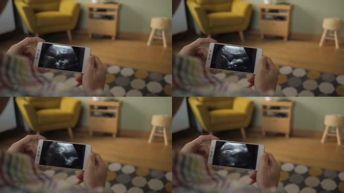 孕妇坐在家里的沙发上看着智能手机上的超声波扫描。妊娠晚期。孕妇在手机上观看超声波视频。妇科分娩。