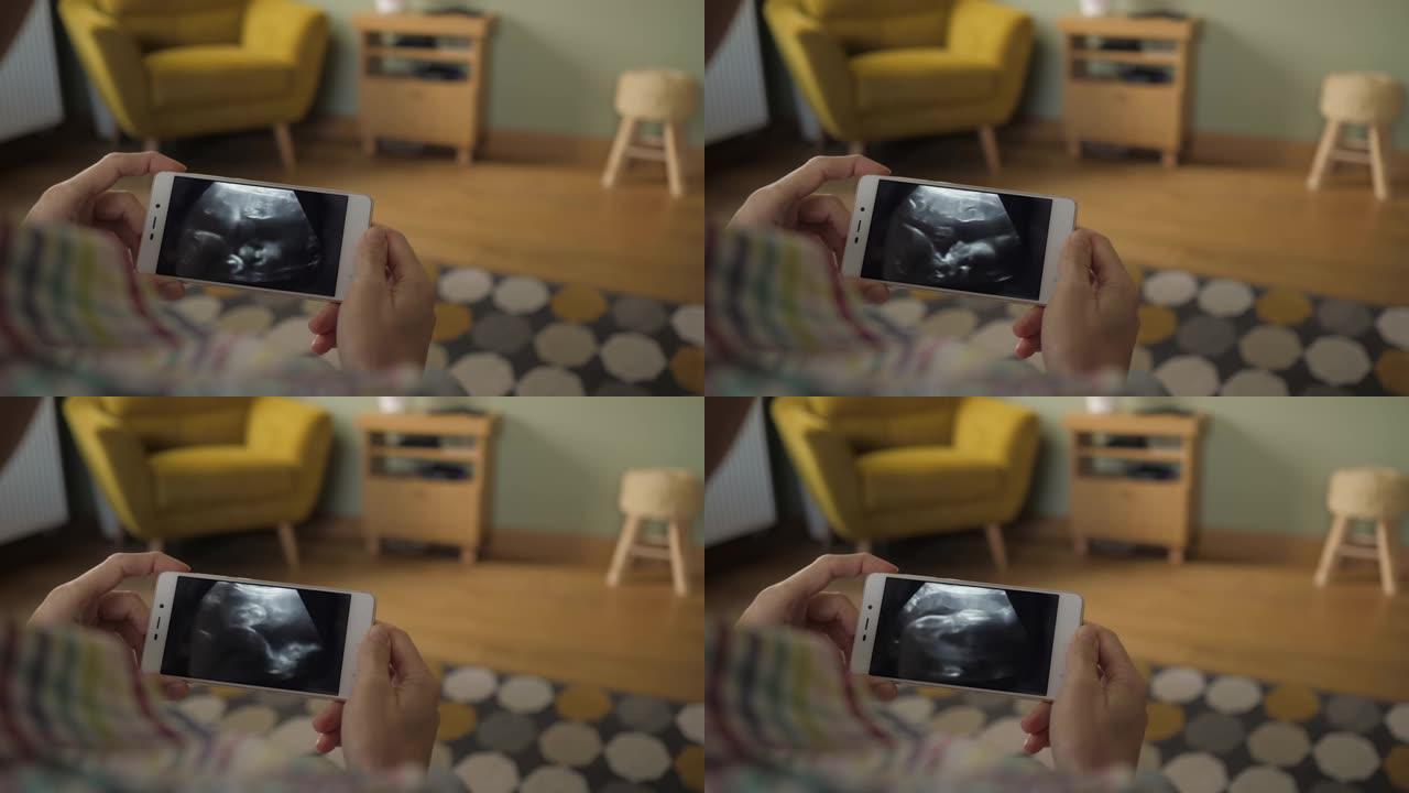 孕妇坐在家里的沙发上看着智能手机上的超声波扫描。妊娠晚期。孕妇在手机上观看超声波视频。妇科分娩。