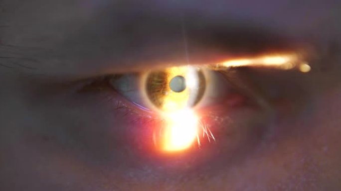 临床用裂隙灯眼科检查。眼科检查的特写。