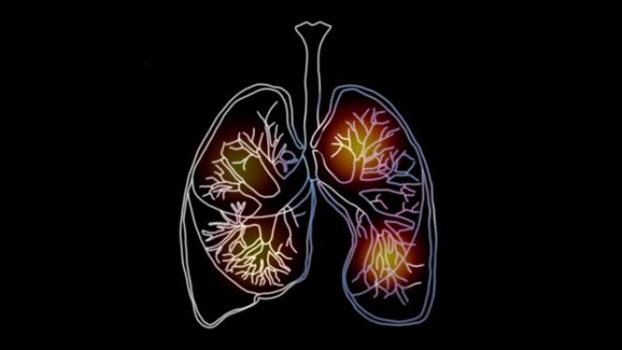 人肺。冠状病毒病毒肺损伤19。技术概念，人类肺的动画。4K