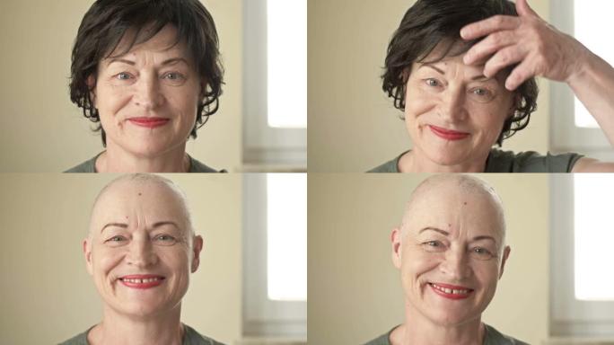特写。女人在化疗后从光头上摘下假发，试图通过眼泪微笑