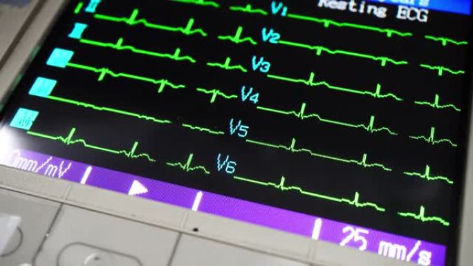 心电图心电图心率心脏死亡生命体征监测仪