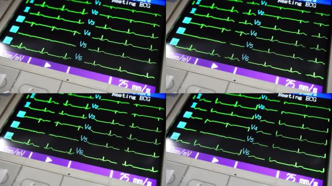 心电图心电图心率心脏死亡生命体征监测仪