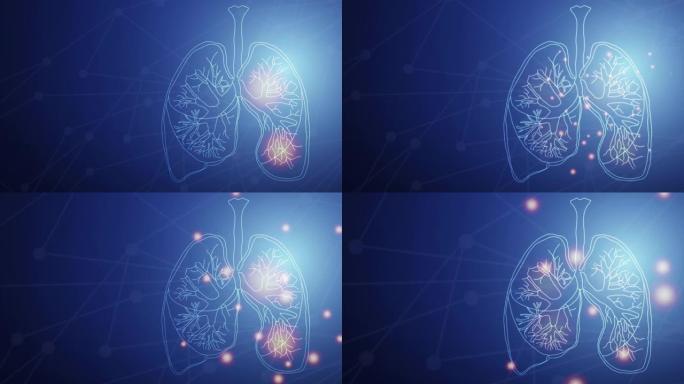 人肺。冠状病毒病毒肺损伤19。技术概念，人类肺的动画。