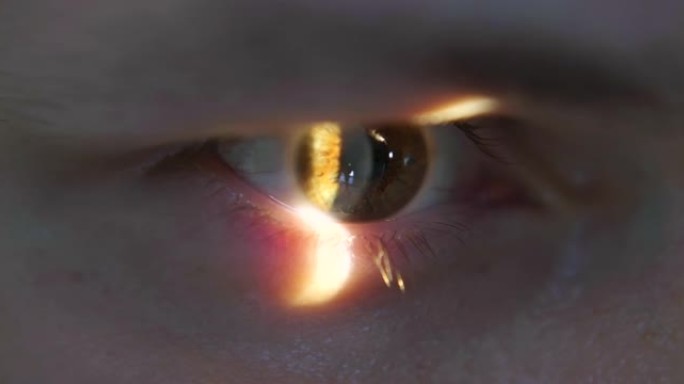 在医学眼科诊所使用激光和裂隙灯进行检查时的特写眼睛