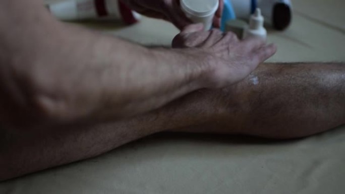 男子涂抹奶油和按摩受伤的膝盖。