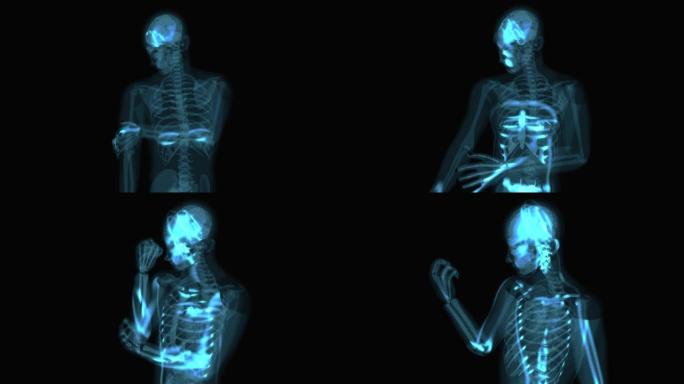 4k肘部疼痛的抽象x射线解剖概念