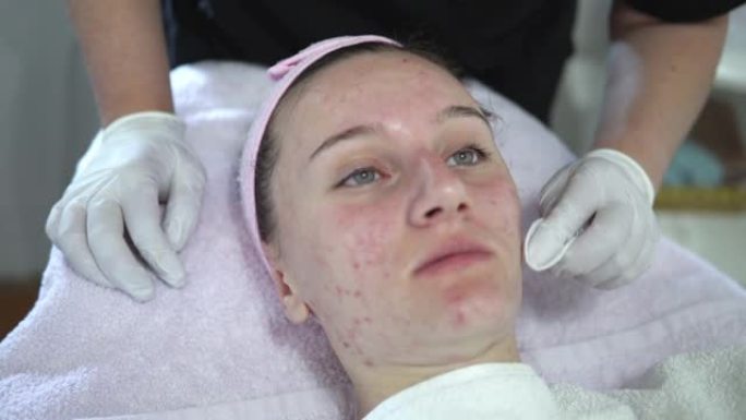 美容师在美容院对面部皮肤进行微晶磨皮手术后清洁年轻女性的面部。美容和专业护肤