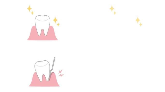比较健康牙龈和牙龈与牙周病的动画视频
