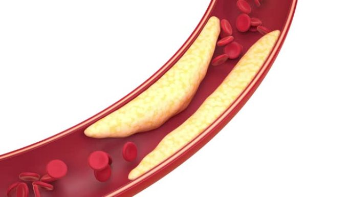 血管中的脂肪和细胞，3d渲染。
