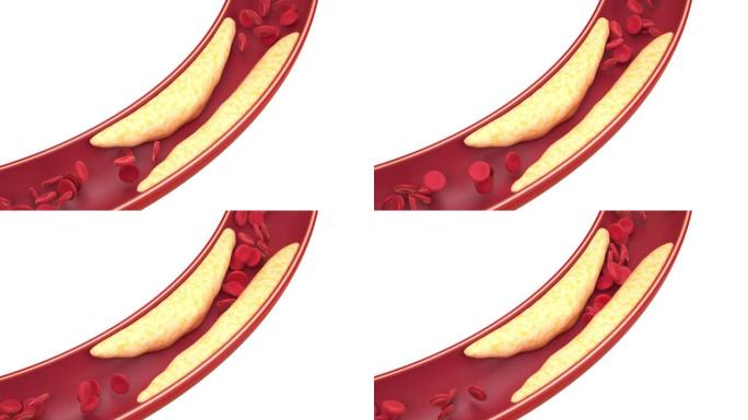 血管中的脂肪和细胞，3d渲染。
