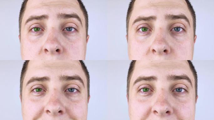 一个有着不同颜色眼睛的男人看着框架。右眼为蓝色，左眼为绿色。异色症。基因突变。多色眼睛。