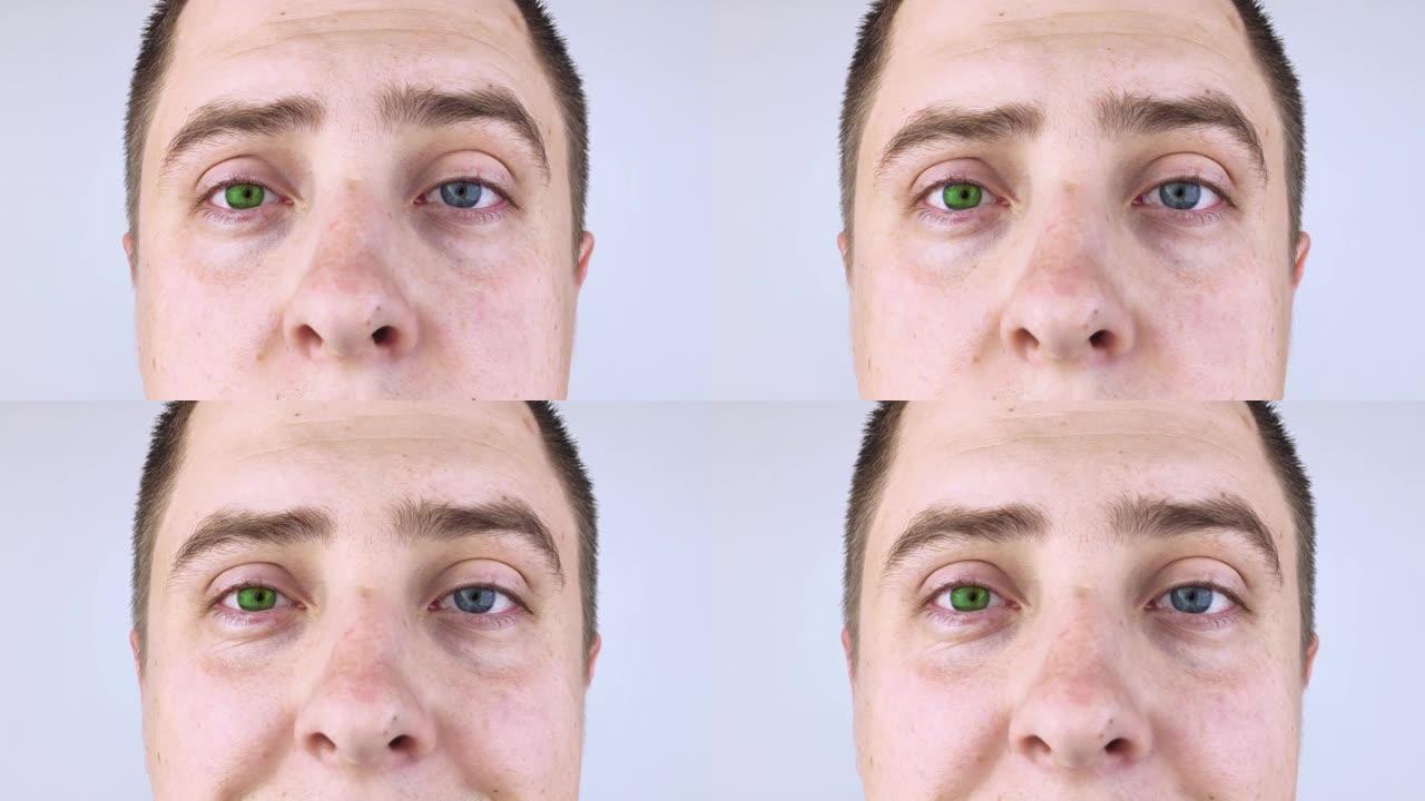 一个有着不同颜色眼睛的男人看着框架。右眼为蓝色，左眼为绿色。异色症。基因突变。多色眼睛。