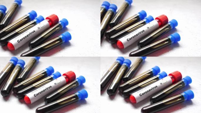 白色背景上电晕病毒血液试管的特写