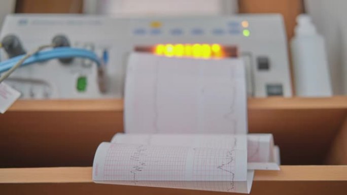 在医院分娩期间监测母婴健康的设备上的心电图