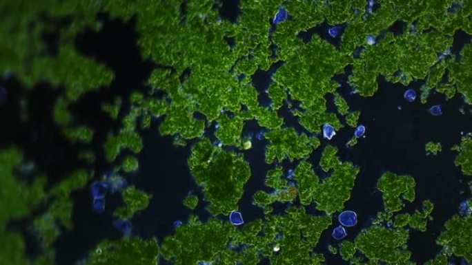 涡旋菌菌落在广阔的单细胞藻类中狩猎。显微镜下有许多微生物的惊人缩影。暗场法。自然环境中的氧气生产者。